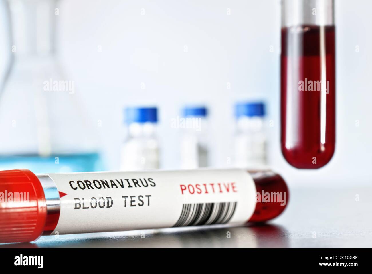 Sample vial with blood, label says coronavirus test, positive result ...