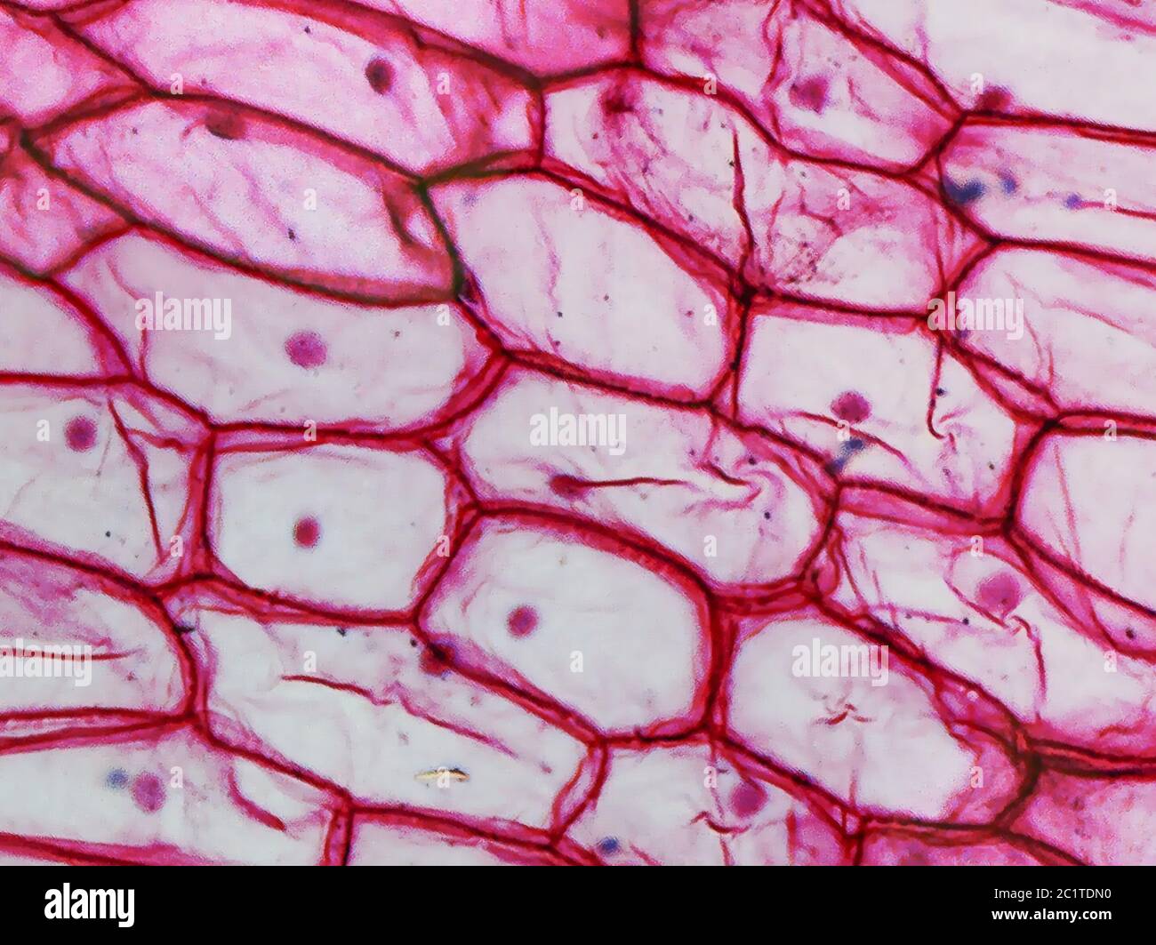 onion epidermal cells under microscope