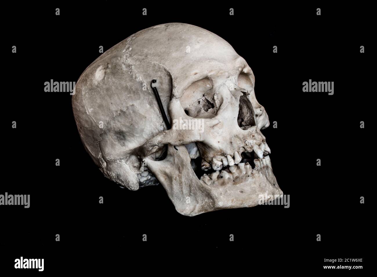 real human skull on black background side view Stock Photo