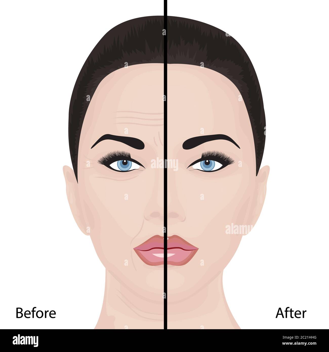Aging face lifting  wrinkles treatment cosmetology facelift rejuvenation Stock Photo