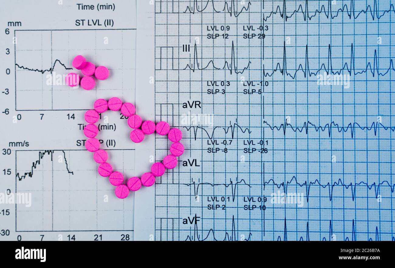 EKG or ECG (Electrocardiogram) graph report paper. EST ( Exercise Stress Test ) result and pink heart shape made from warfarin tablet pills. Warfarin Stock Photo