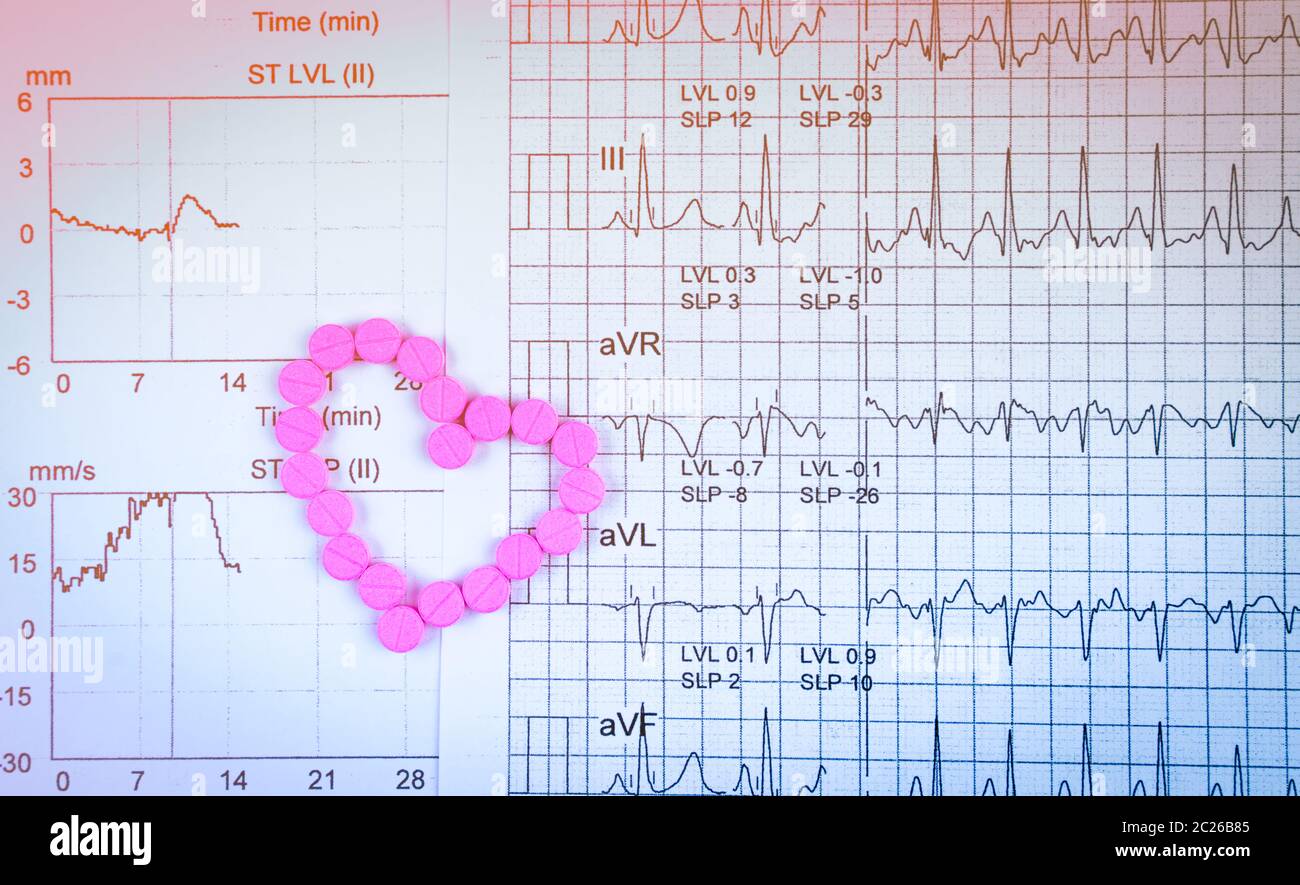 EKG or ECG (Electrocardiogram) graph report paper. EST ( Exercise Stress Test ) result and pink heart shape made from warfarin tablet pills. Warfarin Stock Photo