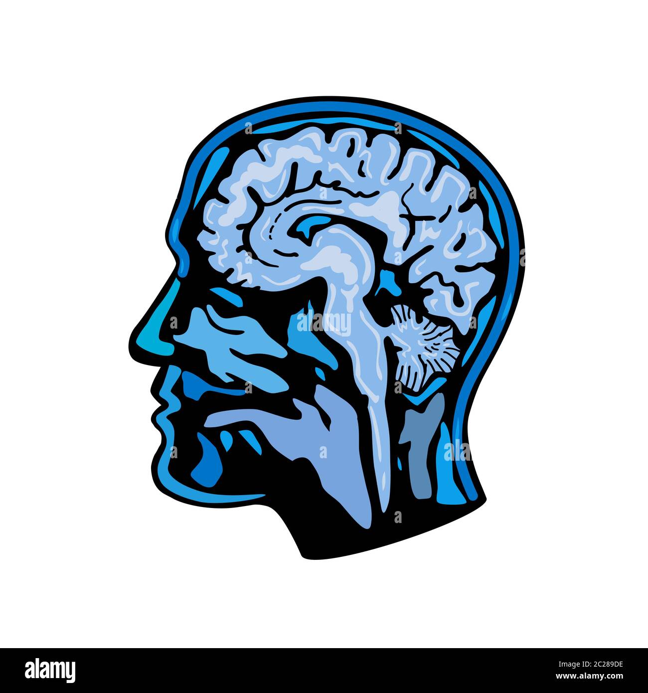 Retro style illustration of a  a brain scan or scanning, neuroimaging, brain imaging or computerised tomography scan viewed from side on isolated back Stock Photo