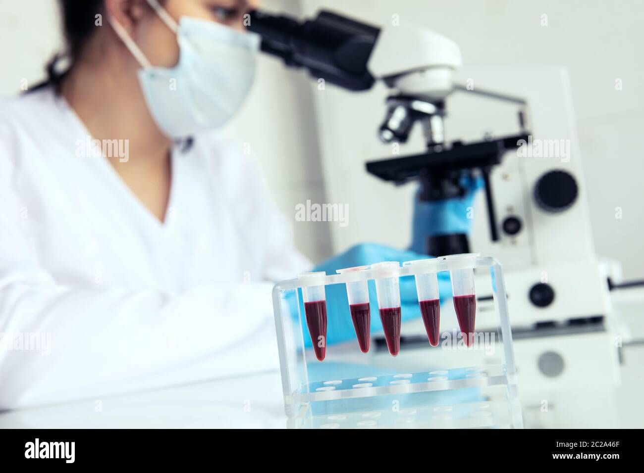 Eppendorf test-tubes with blood to examine. Eppendorf test-tubes with blood and female medician examines samples under microscope Stock Photo
