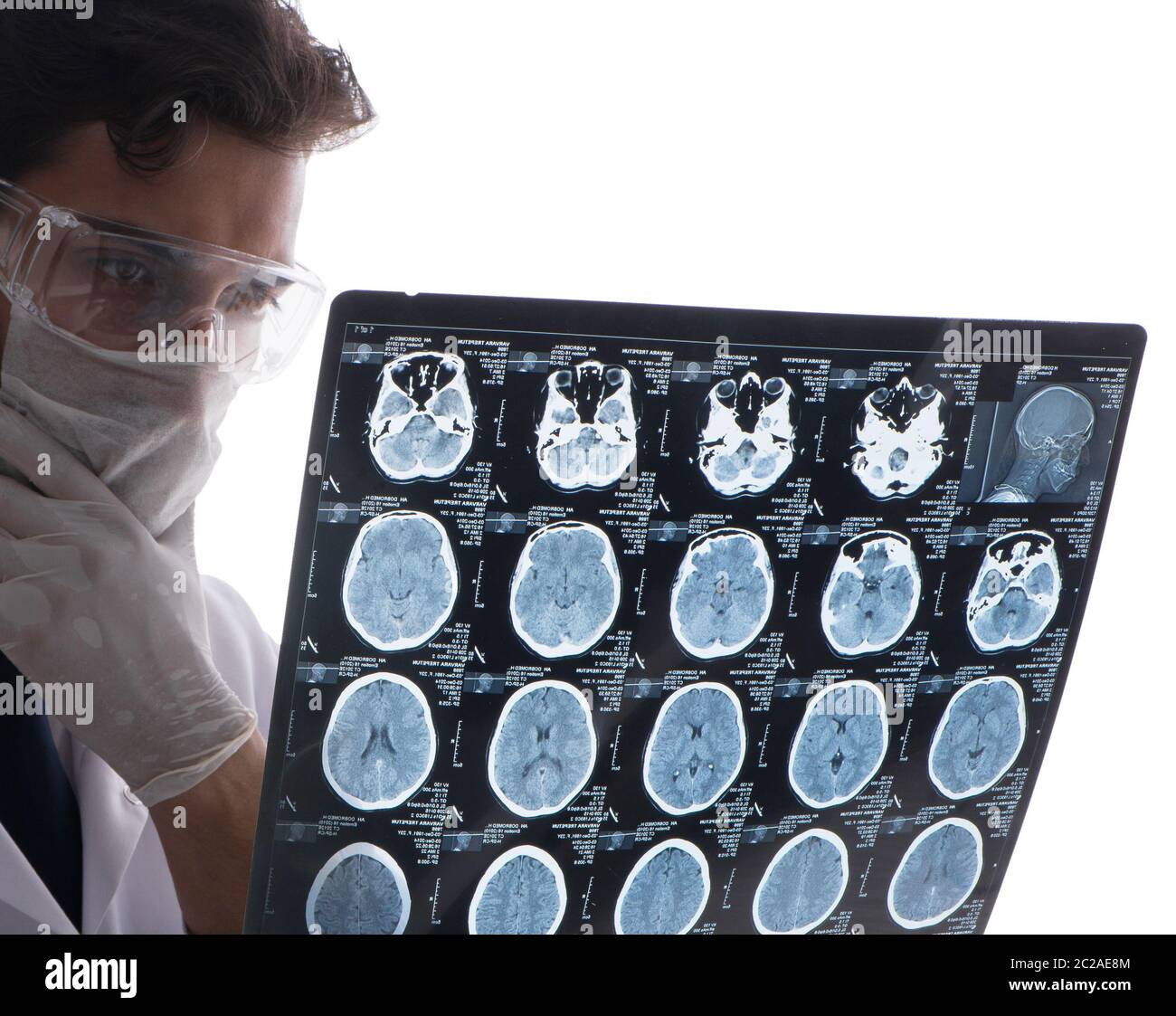 Young doctor looking at x-ray images isolated on white Stock Photo - Alamy
