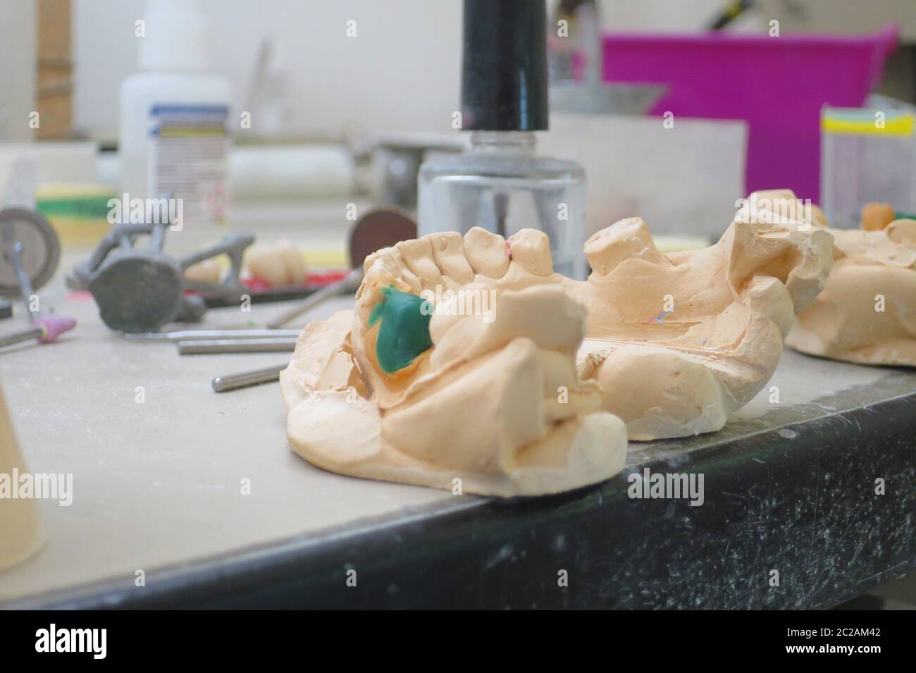 dental laboratory denture dental impressions Stock Photo Alamy
