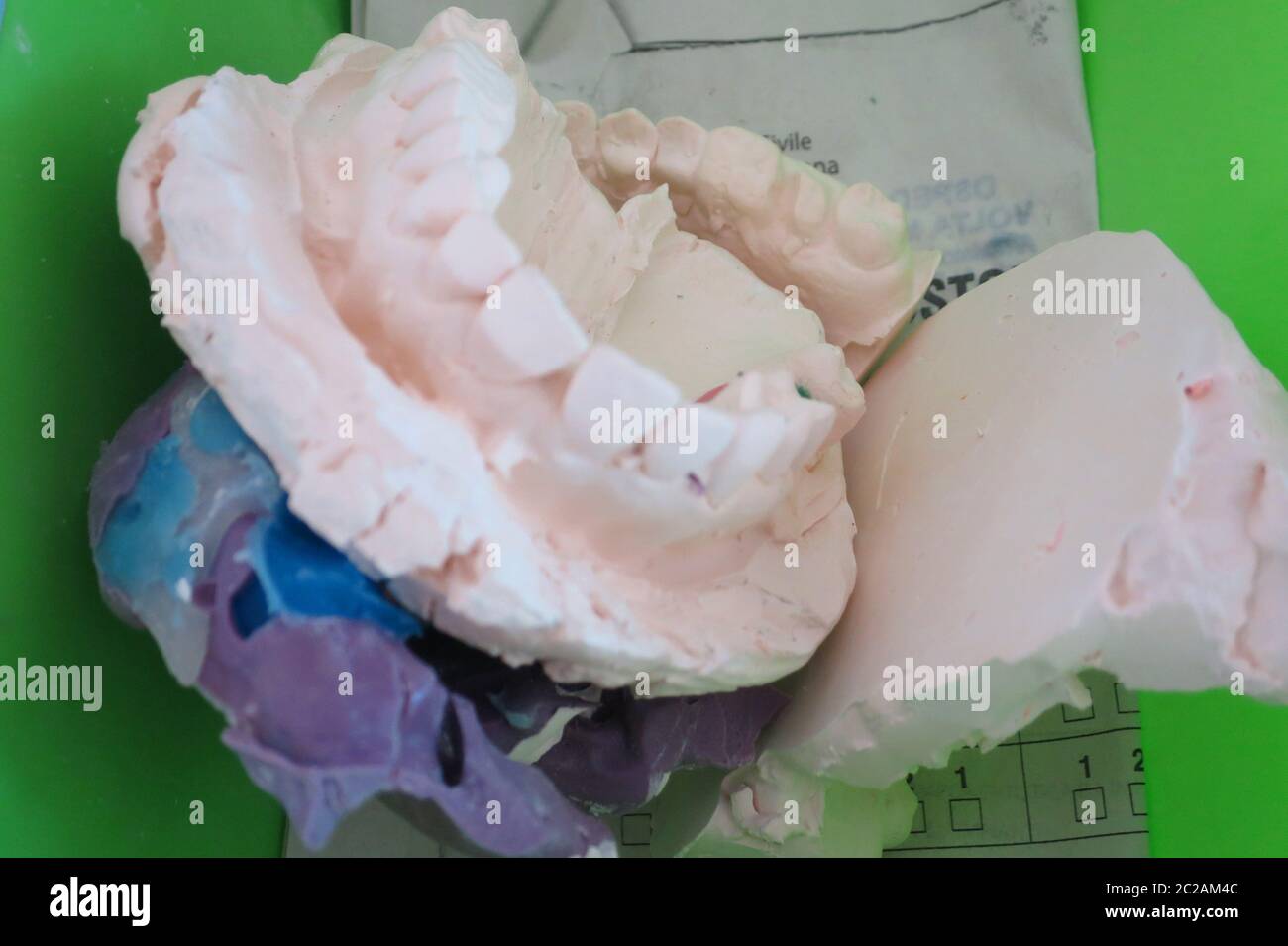 dental laboratory denture dental impressions Stock Photo Alamy