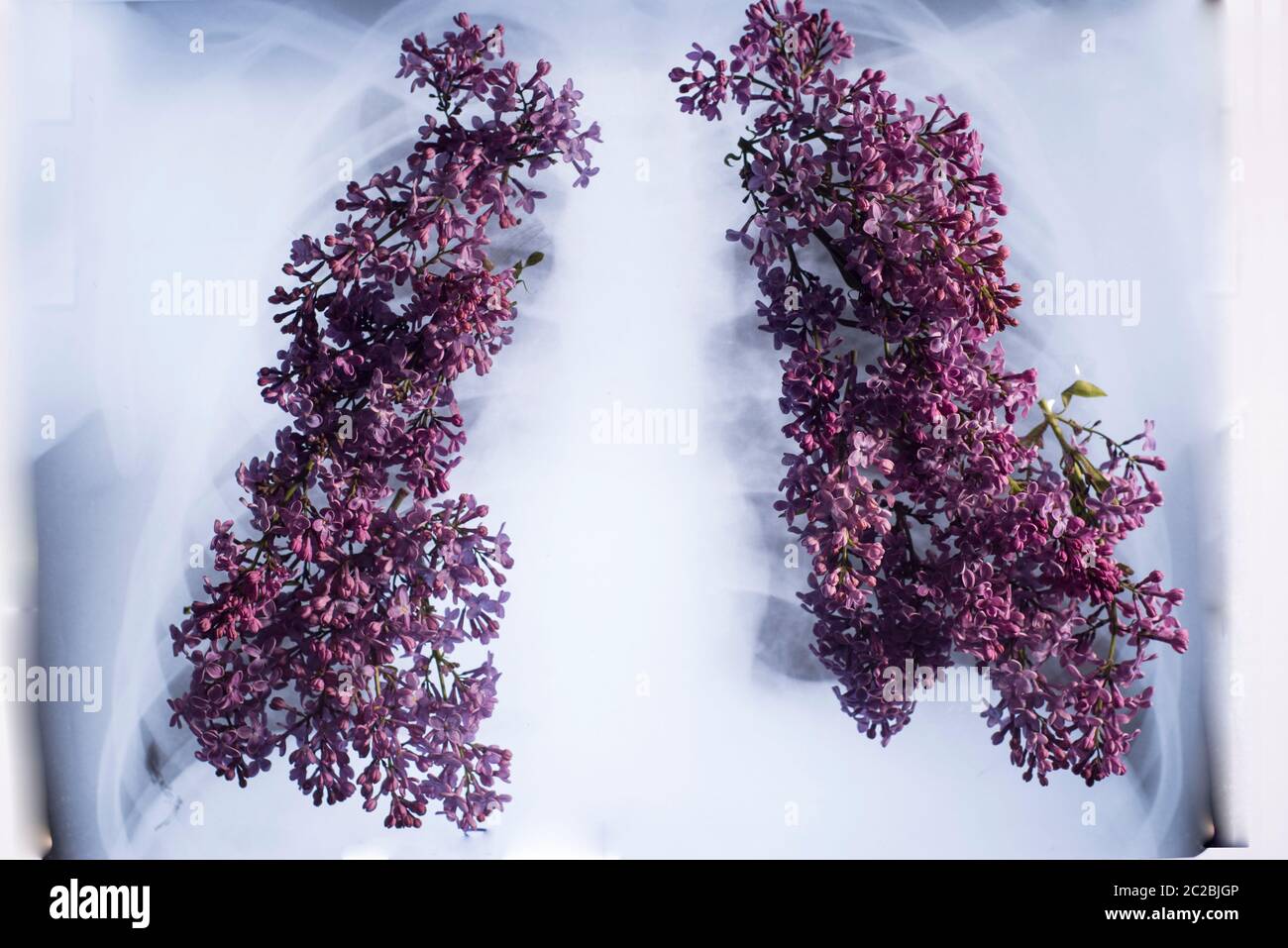 Xray of the lungs, sprouting with pink flowers in the form of the