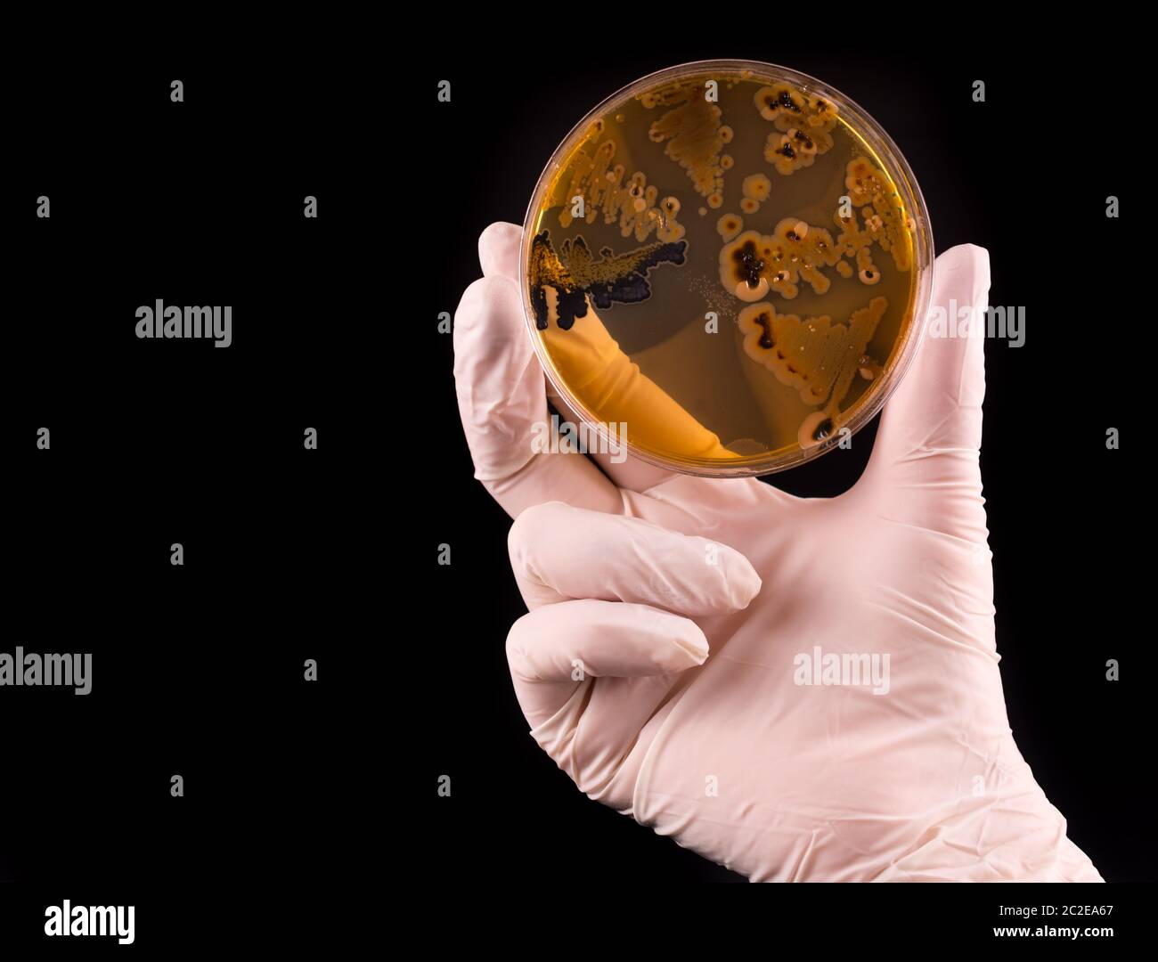 Scientist's hand holding petri dish infected with Salmonella bacteria on black background Stock Photo