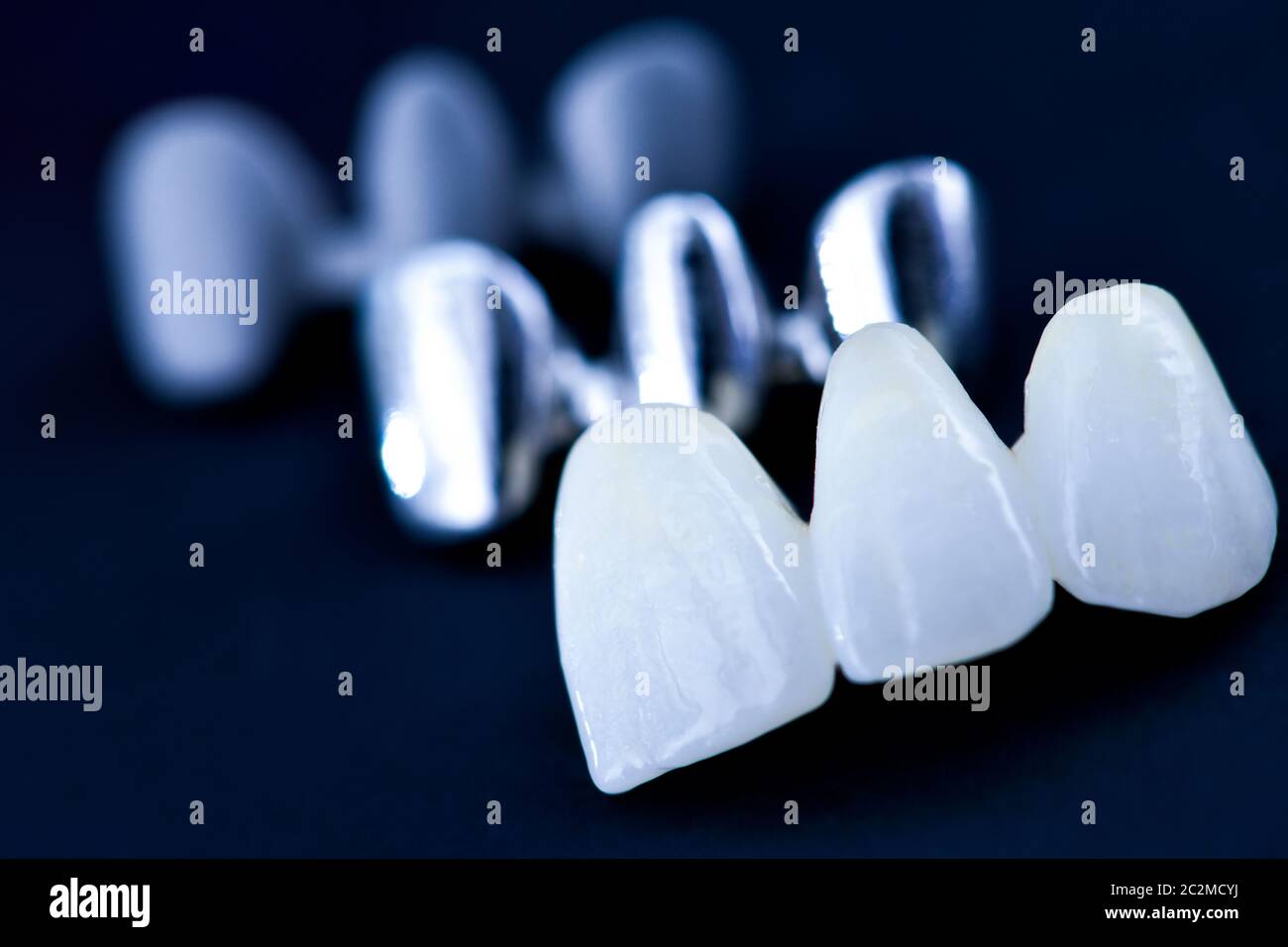 different types of dental tooth crowns Stock Photo Alamy