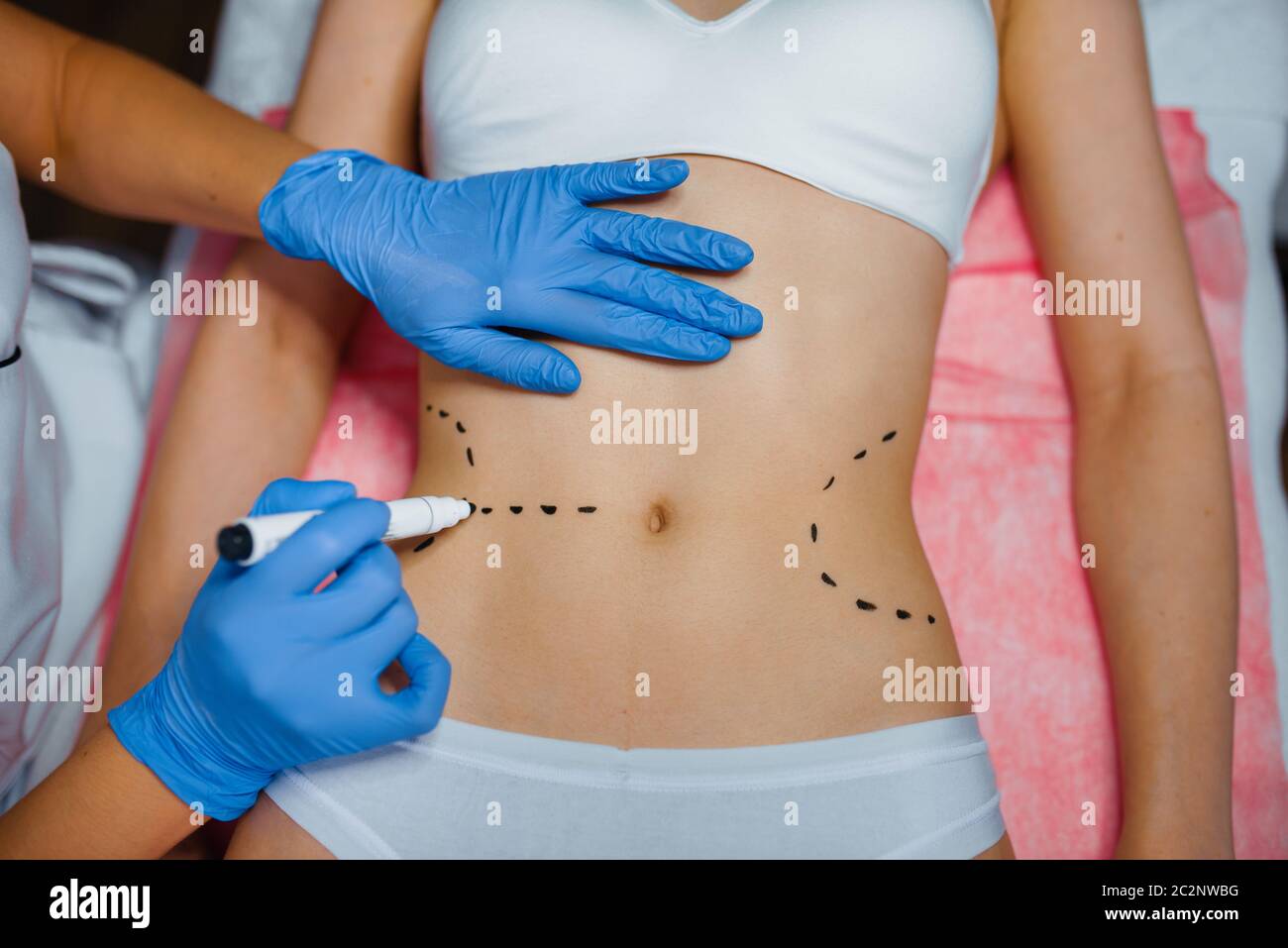 Cosmetician applies markers to female patient body, botox injections ...