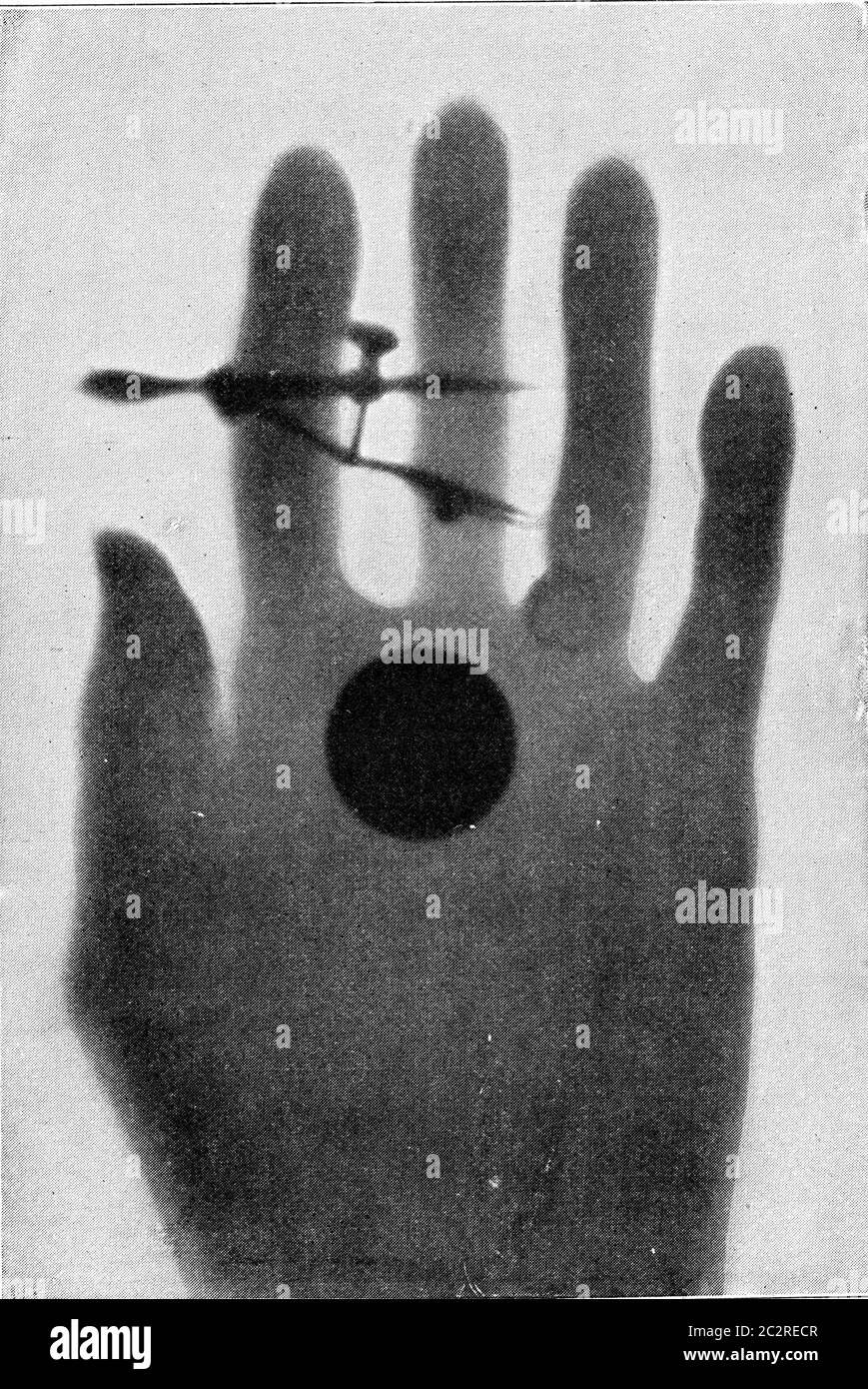 Photograph made with radium rays, vintage engraved illustration. From ...