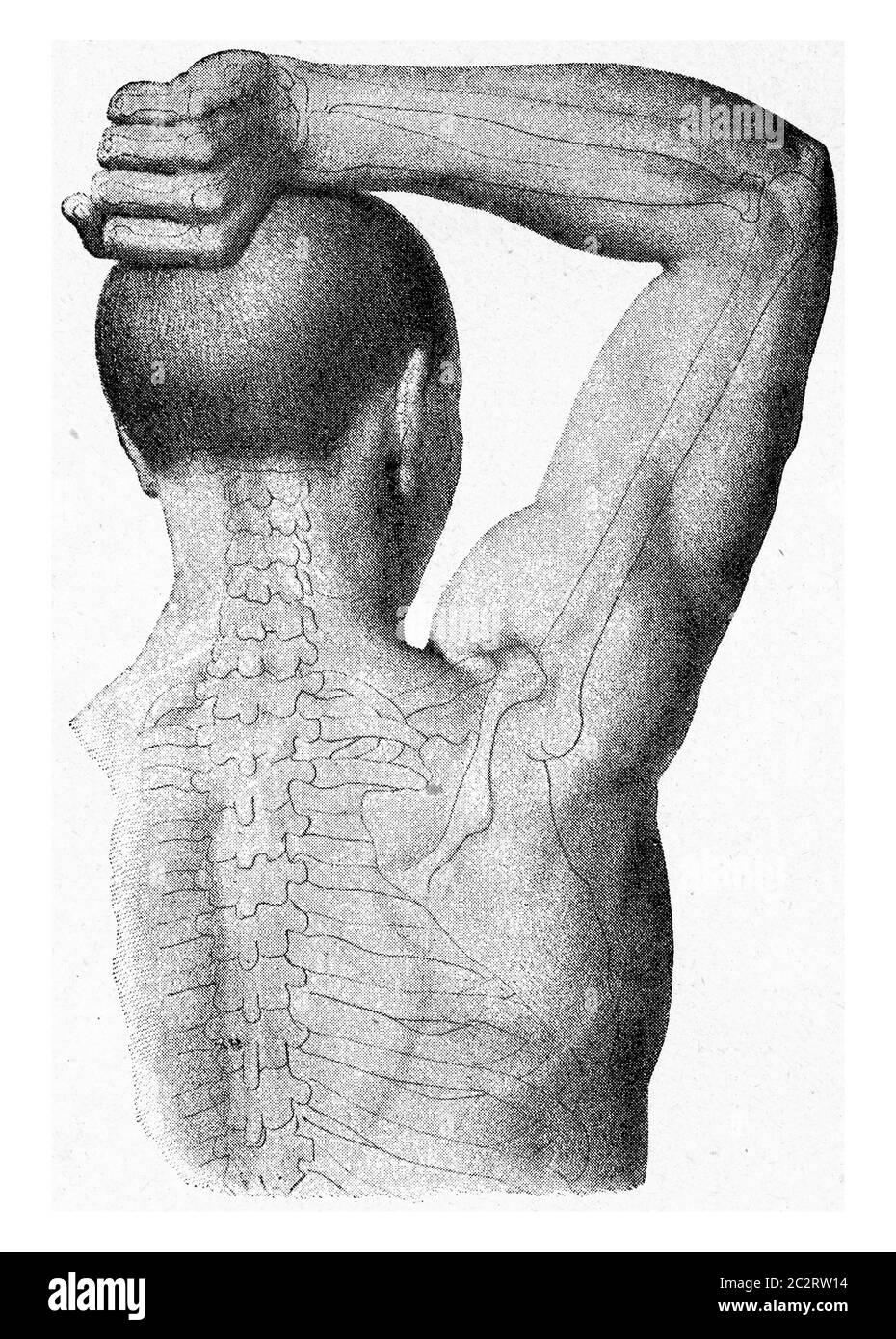The muscles of the arm of the man hand being lifted, vintage engraved illustration. From the Universe and Humanity, 1910. Stock Photo