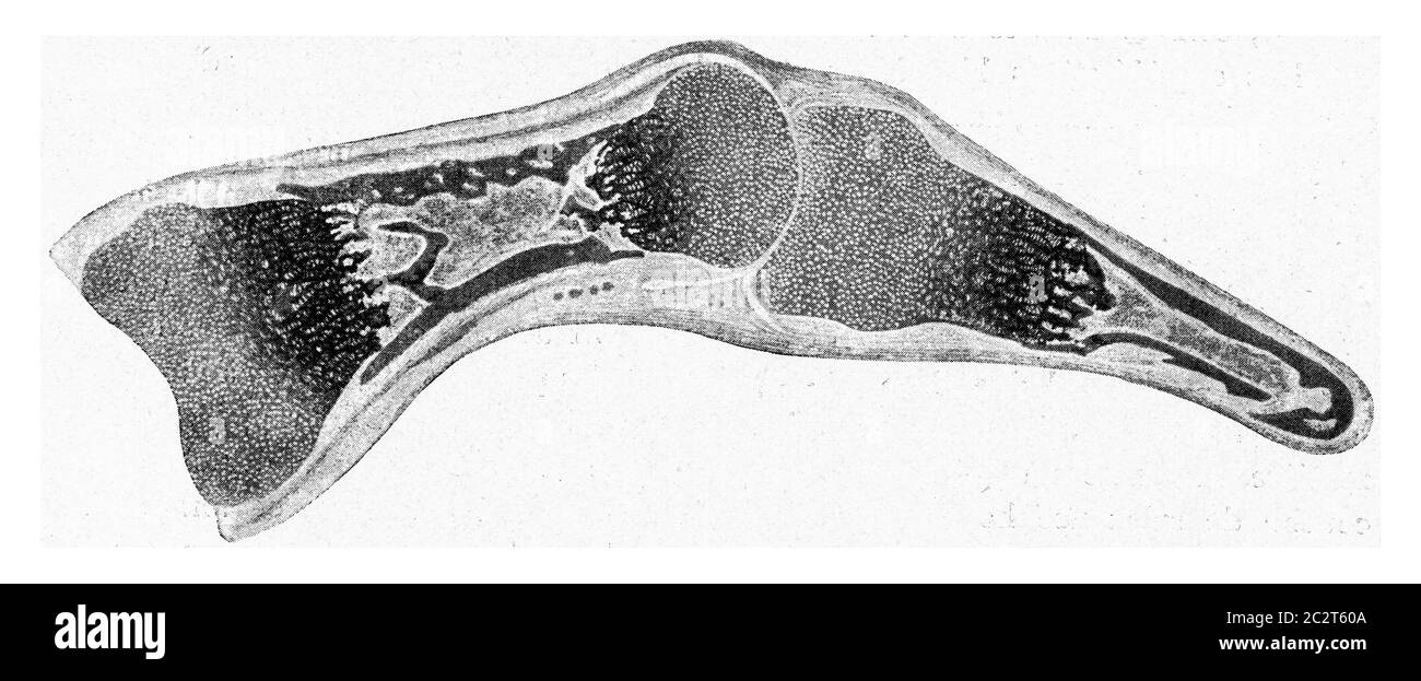 Longitudinal segment through the finger of a human embryo of a certain age, vintage engraved illustration. From the Universe and Humanity, 1910. Stock Photo