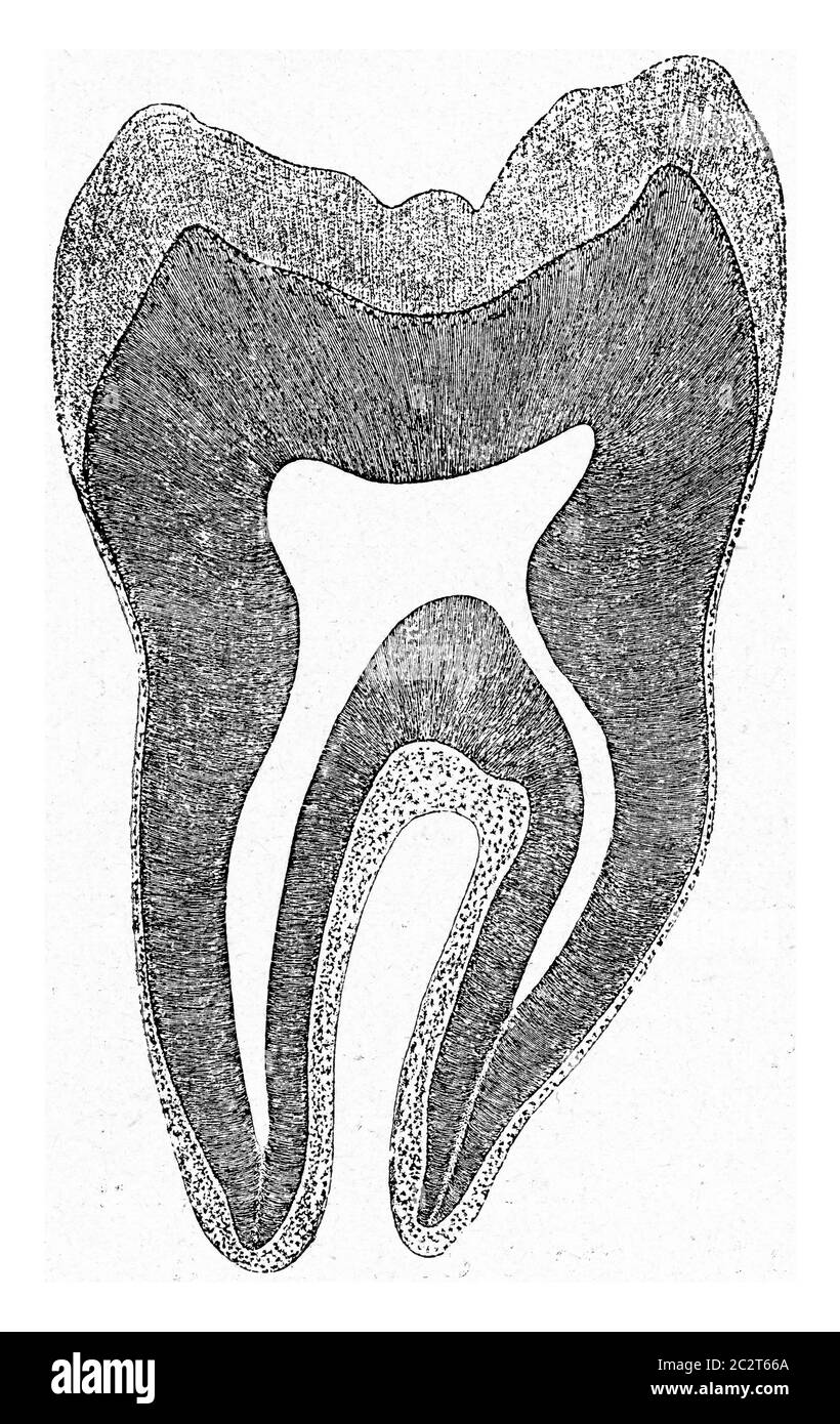 Segment of a human molar tooth, vintage engraved illustration. From the Universe and Humanity, 1910. Stock Photo