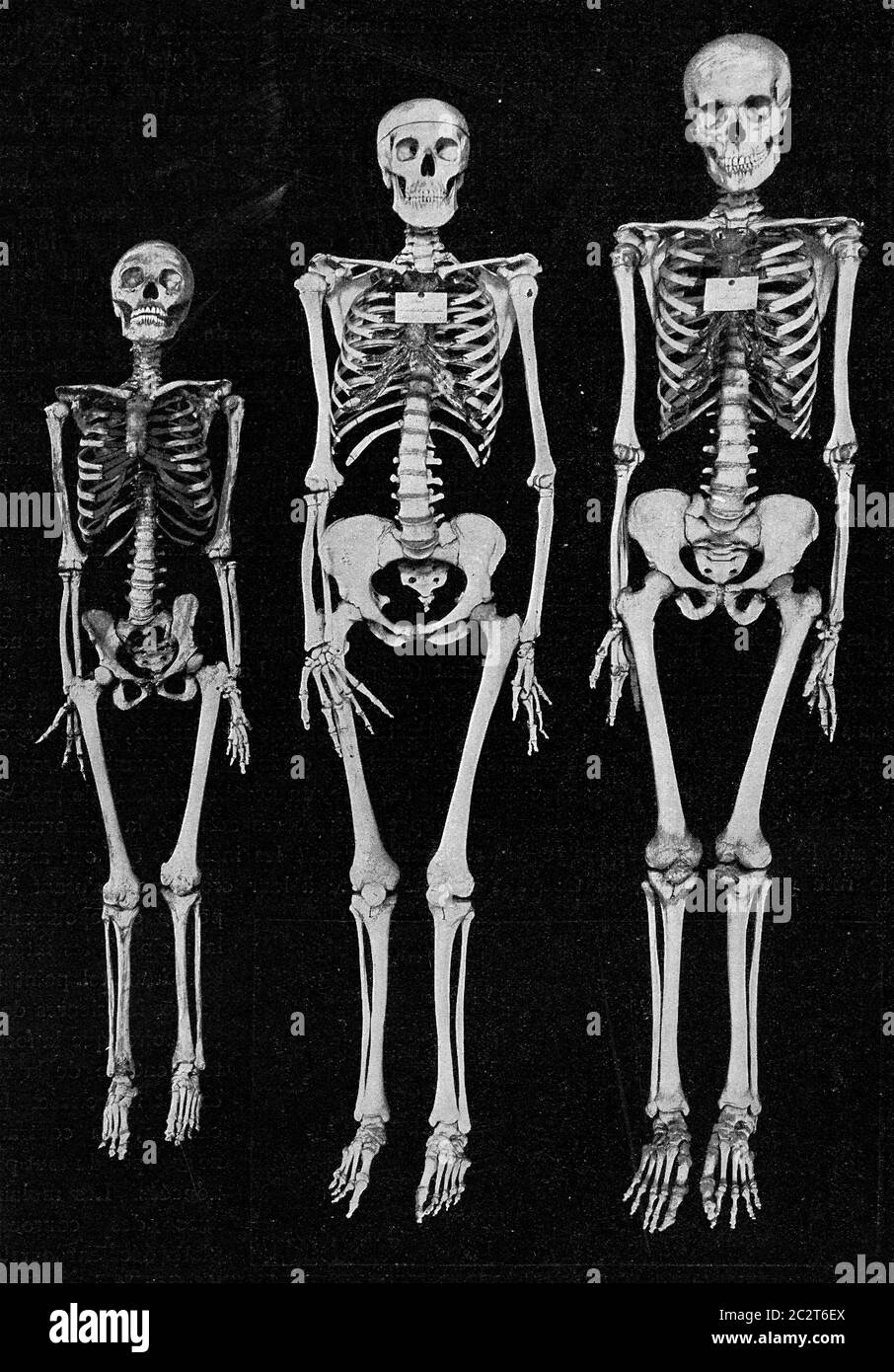 Different sizes of the human skeleton, vintage engraved illustration. From the Universe and Humanity, 1910. Stock Photo