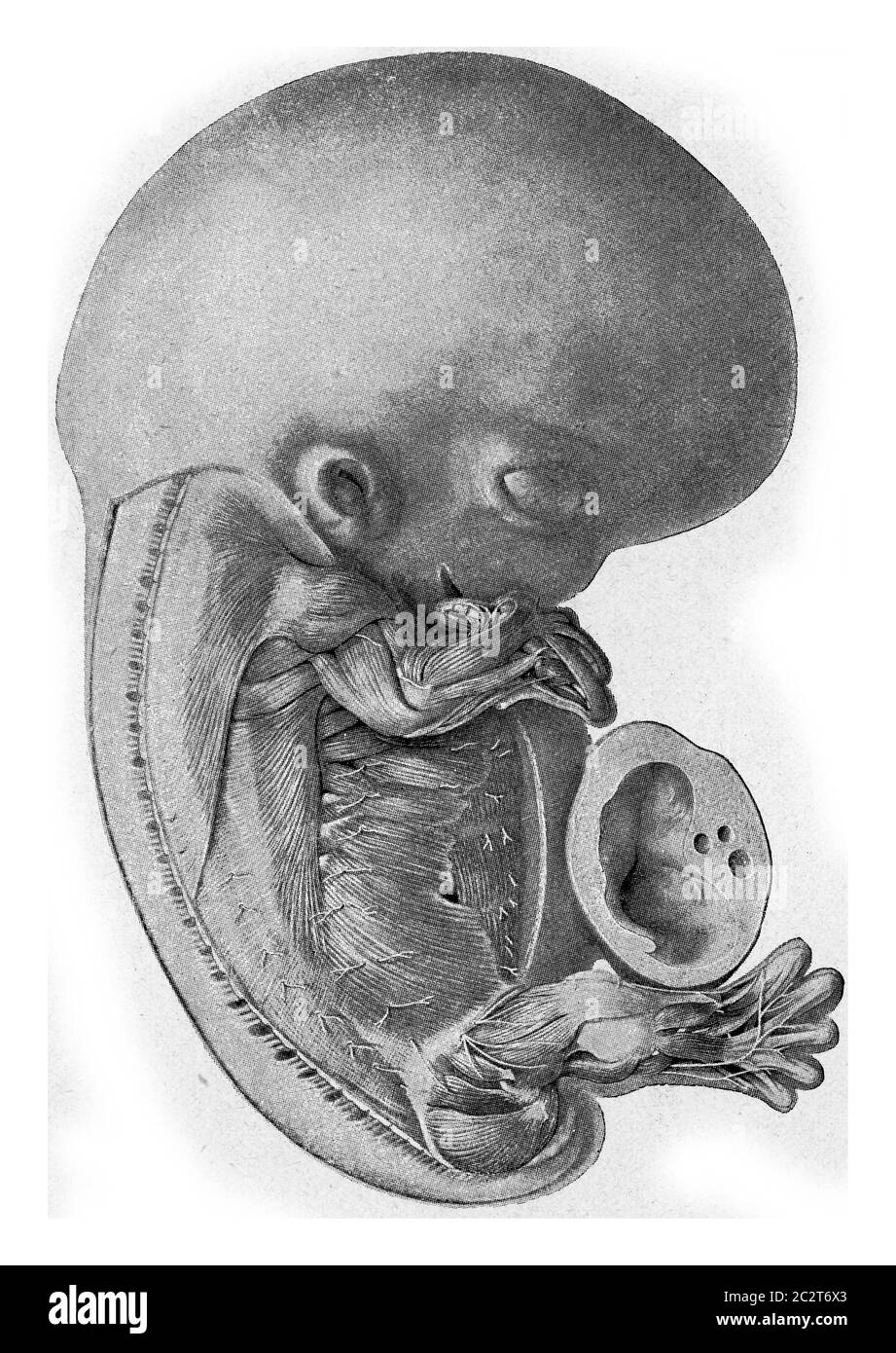 Human embryo, vintage engraved illustration. From the Universe and Humanity, 1910. Stock Photo