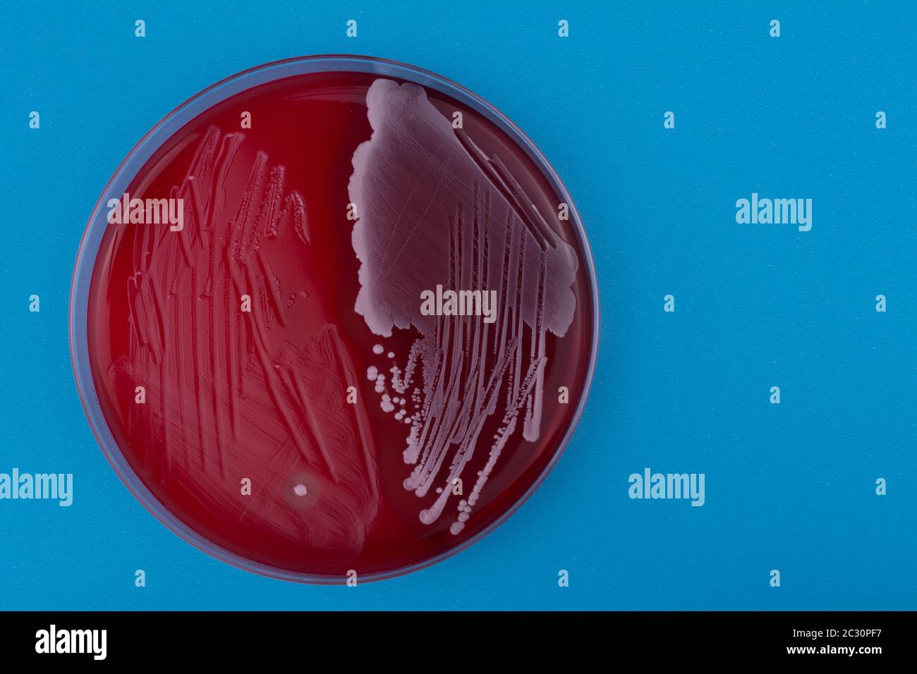Petri dish with bacteria on blue background. Staphylococcus aureus and streptococcus beta-hemolytic bacteria on blood agar Stock Photo
