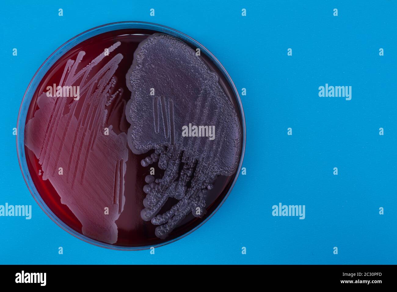 Petri dish with bacteria on blue background. Staphylococcus aureus and pseudomonas aeruginosa bacteria on agar plate Stock Photo