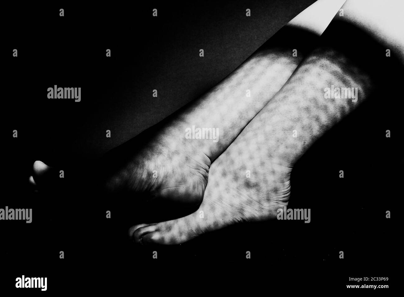 Black And White Leg Portrait Stock Photo Alamy