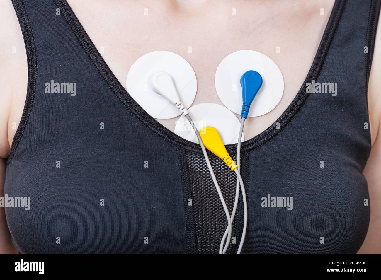 electrodes of Holter monitor of electrocardiogram are attached to chest