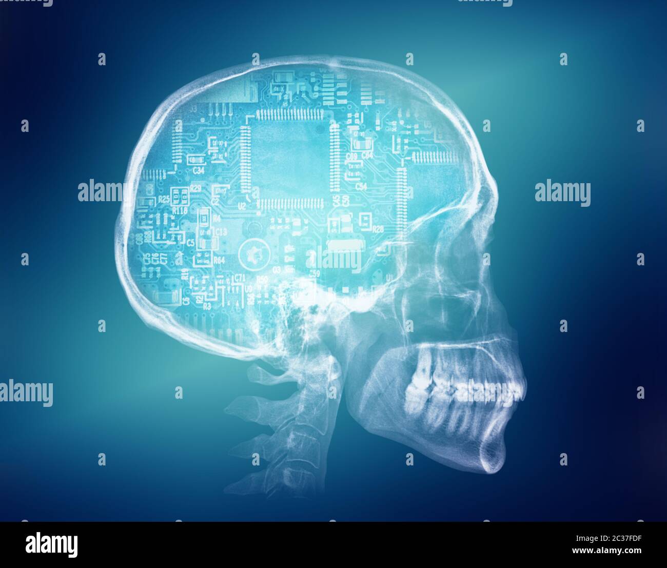 Human skull X-ray image. Artificial intelligence futuristic concept Stock Photo