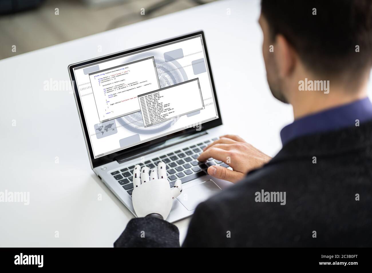 Man With Prosthetic Hand Working On Laptop. Artificial Limb Stock Photo