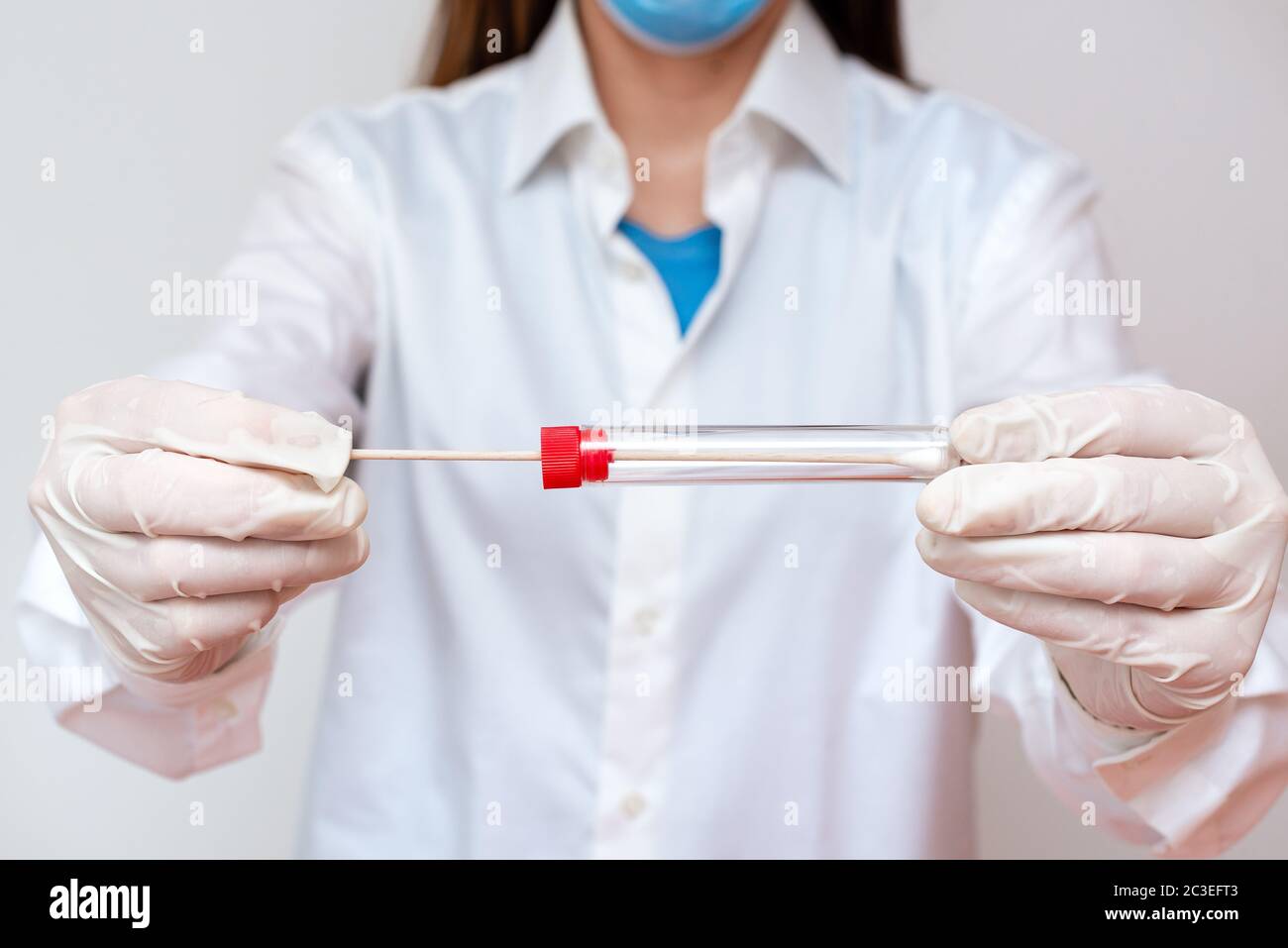 Laboratory Blood Test Sample Shown For Medical Diagnostic Analysis