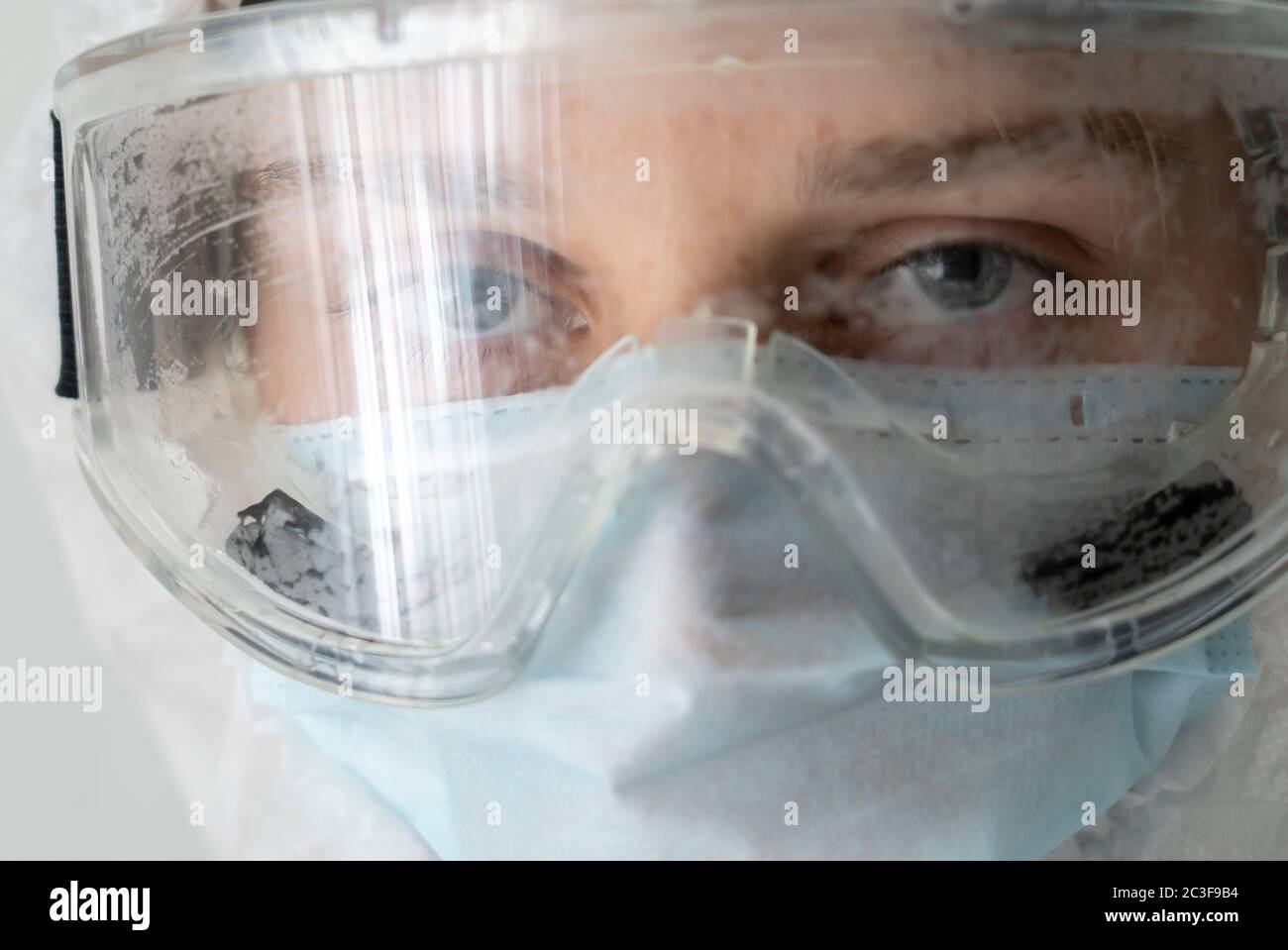 close-up of the doctor's tired eyes through fogged-up safety glasses. Stock Photo