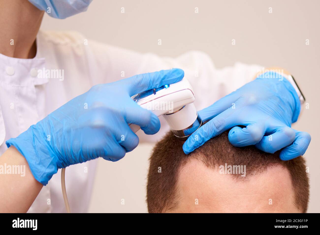 Microscopic examination of the hair and skin of the scalp Stock Photo