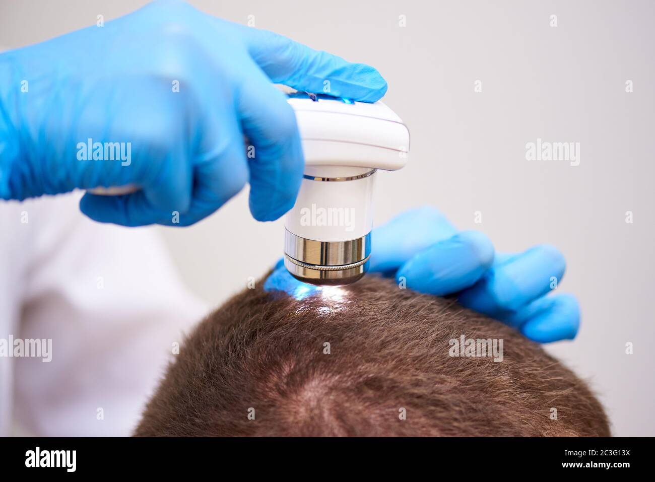 Microscopic examination of the hair and skin of the scalp Stock Photo