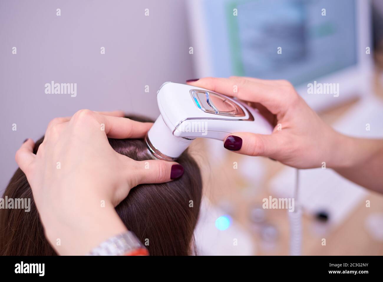 Microscopic examination of the hair and skin of the scalp Stock Photo