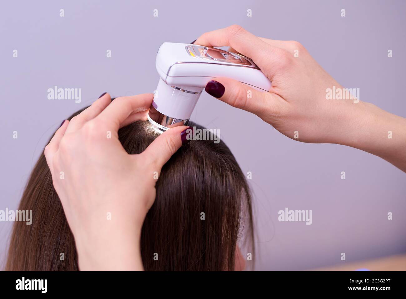 Microscopic examination of the hair and skin of the scalp Stock Photo