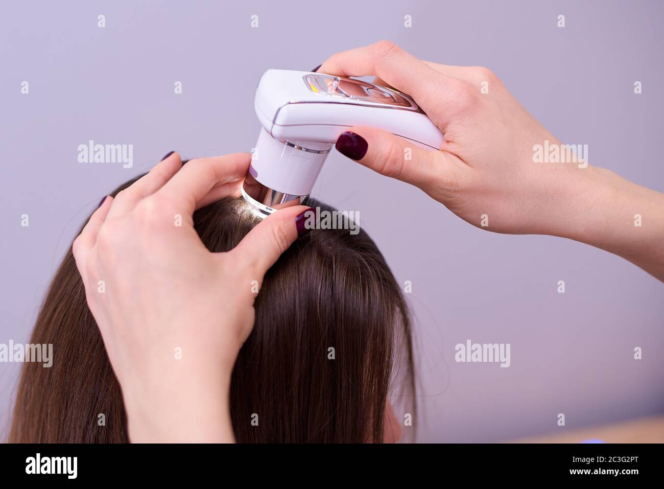 7. The Role of Methyl Blue in Microscopic Examination of Hair Damage - wide 8