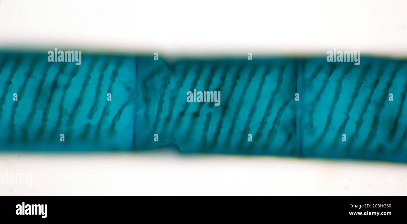 Spirogyra freshwater algae, microscope view Stock Photo - Alamy