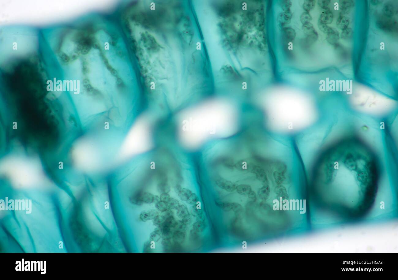 Spirogyra freshwater algae, microscope view Stock Photo