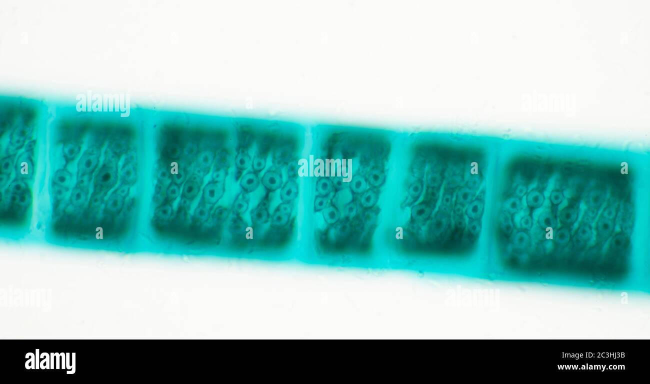 Spirogyra fresh water algae, microscope view Stock Photo