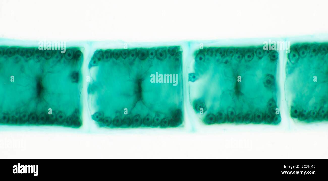 Spirogyra fresh water algae, microscope view Stock Photo