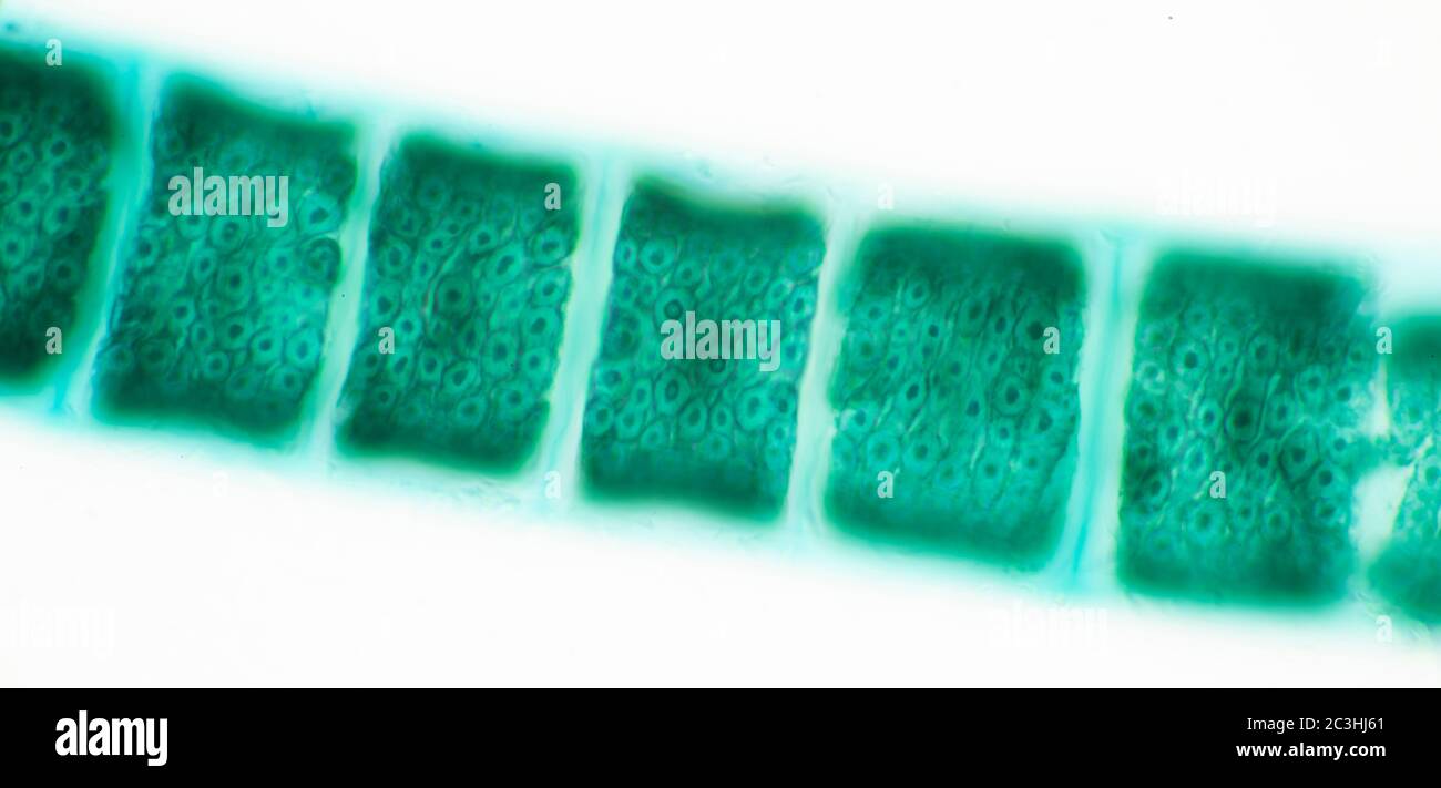Spirogyra fresh water algae, microscope view Stock Photo - Alamy
