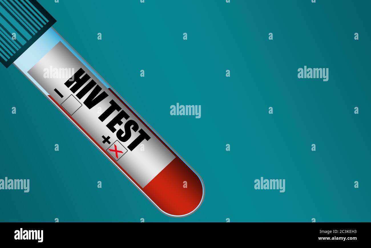 Test tube with sample blood positive HIV virus, 3D rendering Stock