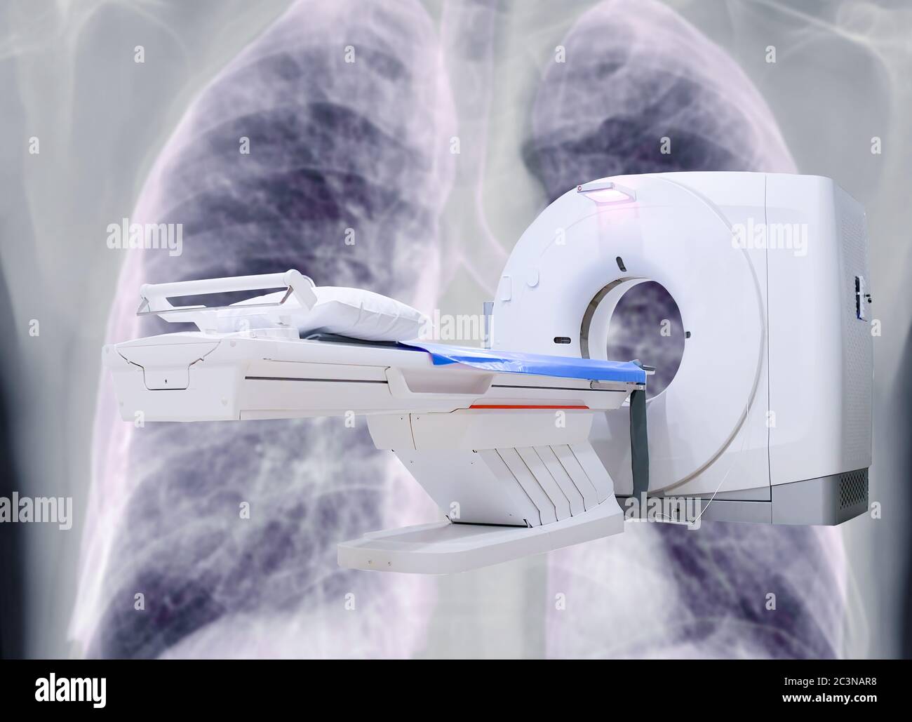 multi detector CT Scanner ( Computed Tomography ) on chest xray