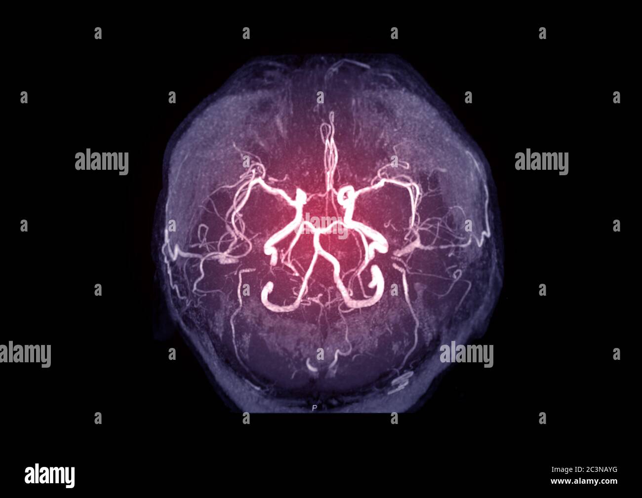 Basilar artery hires stock photography and images Alamy