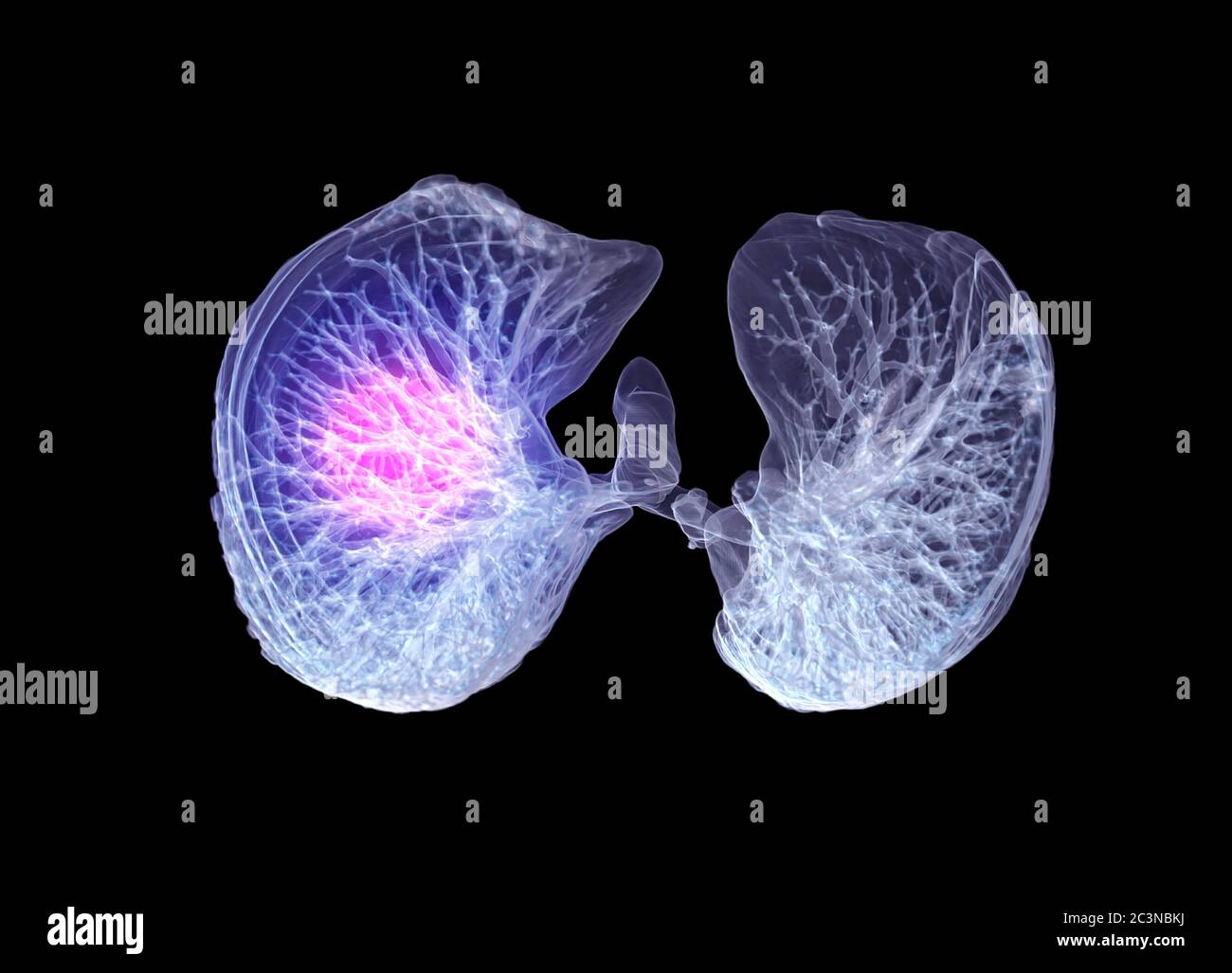 CT Chest or Lung 3D rendering image buttom view for diagnosis TB,tuberculosis and covid-19 . Stock Photo