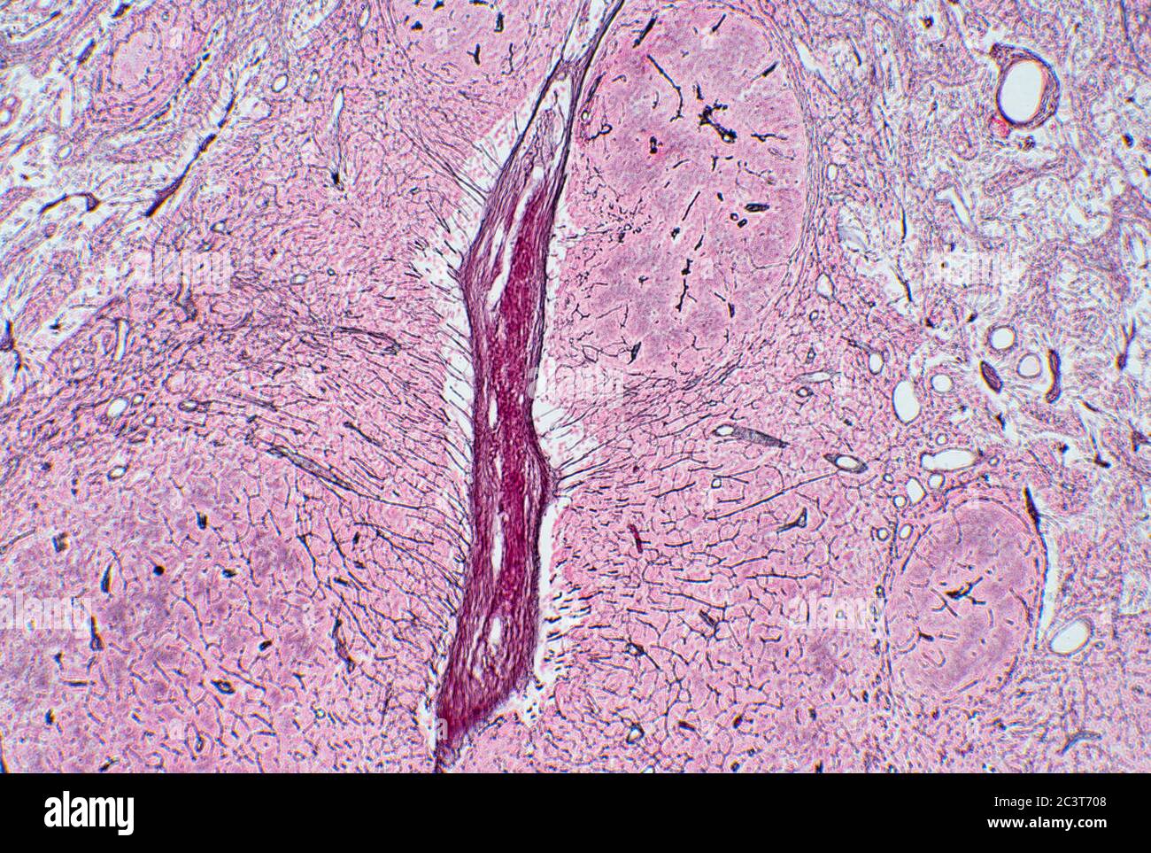 Revenue Arrow Missionary Lymph node microscope hi-res stock photography and images - Alamy