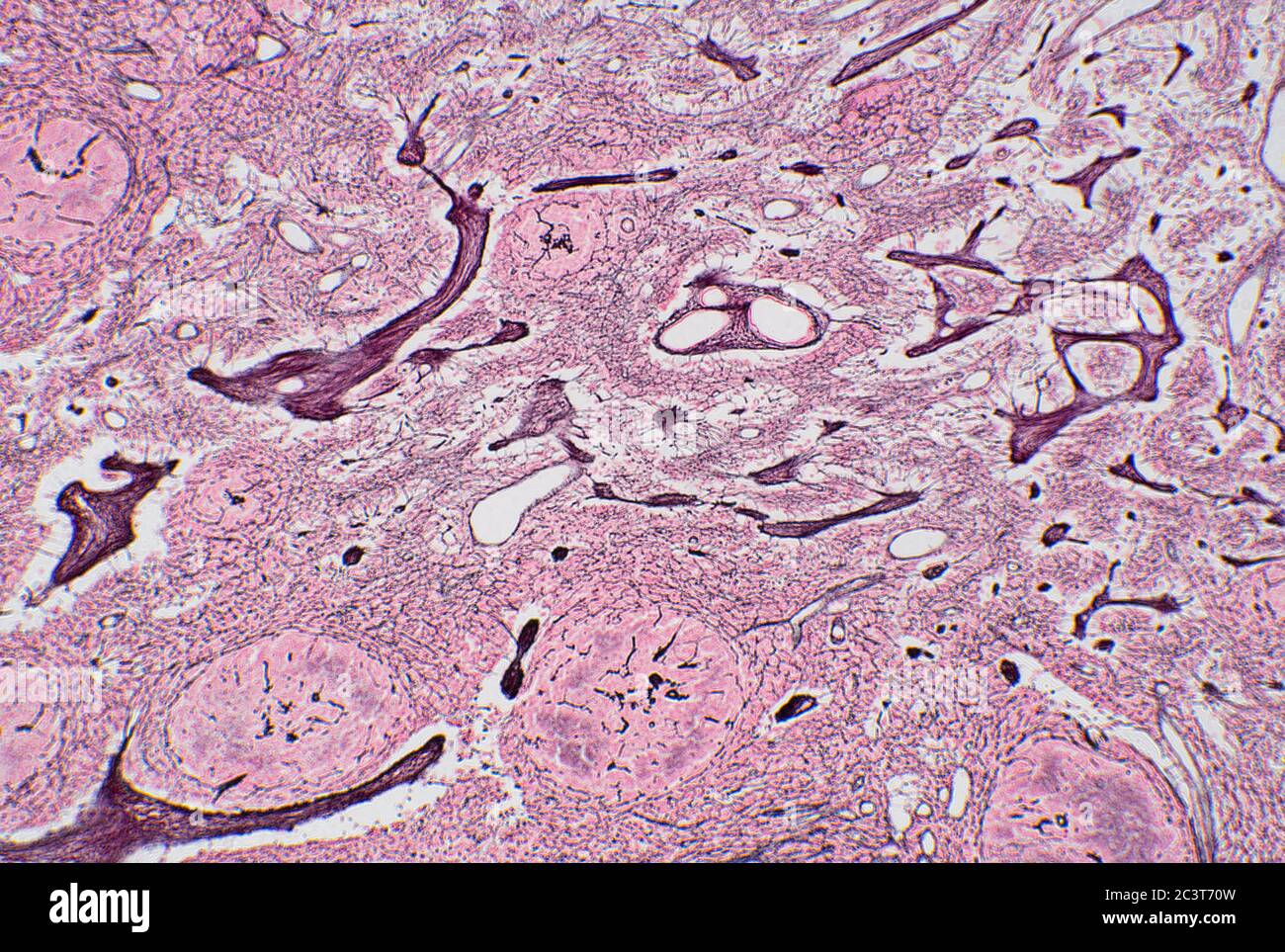 Lymph Node Microscope Slide