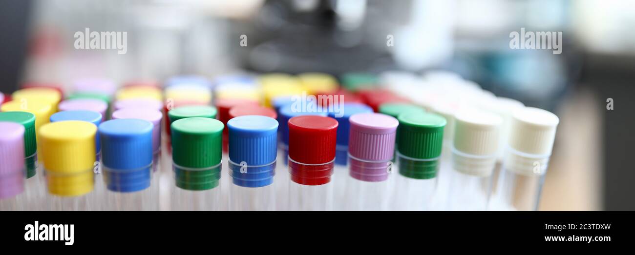 Test tubes with colored caps are in laboratory Stock Photo Alamy