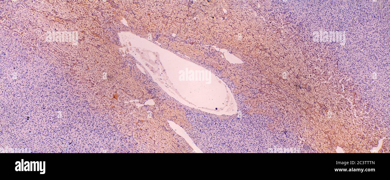Mammal Suprarenal, Adrenalin gland, microscope view Stock Photo