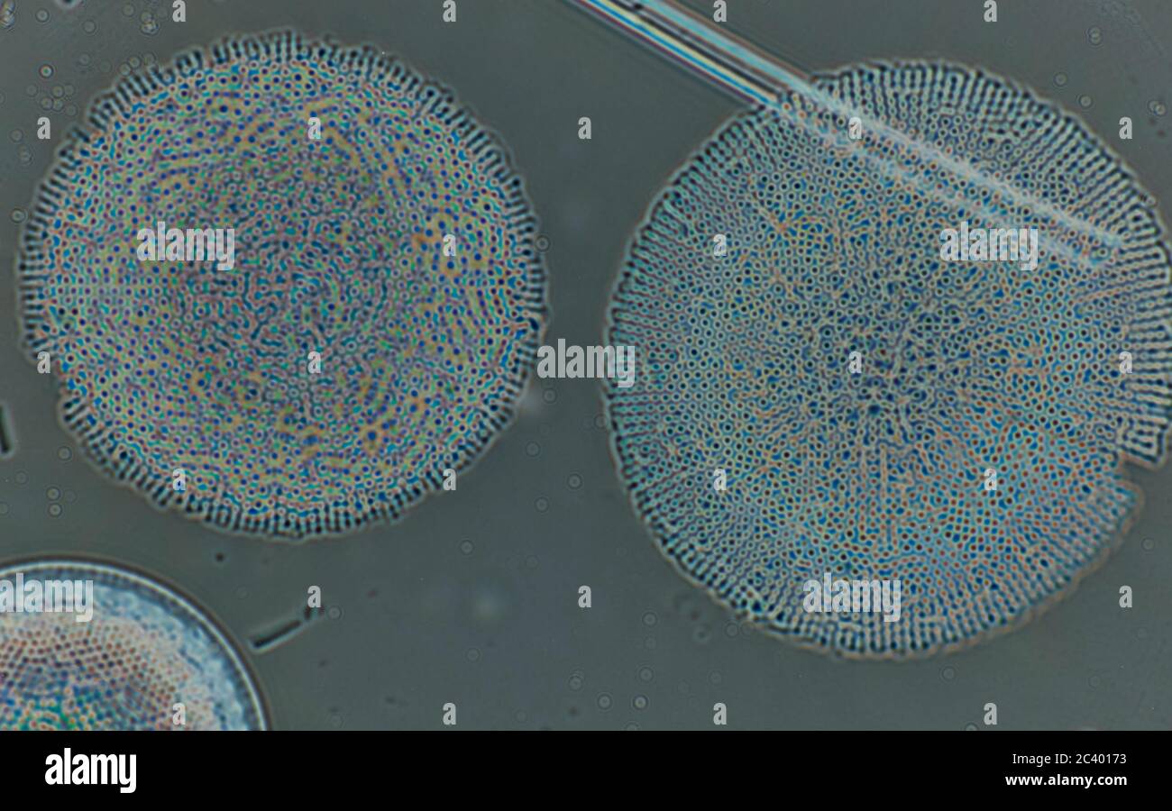 Phytoplankton biodiversity microscope hi-res stock photography and ...