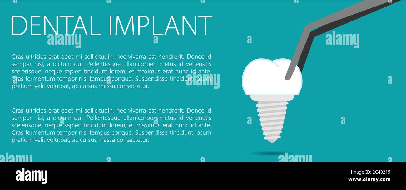 Dental implant flat vector Stock Vector