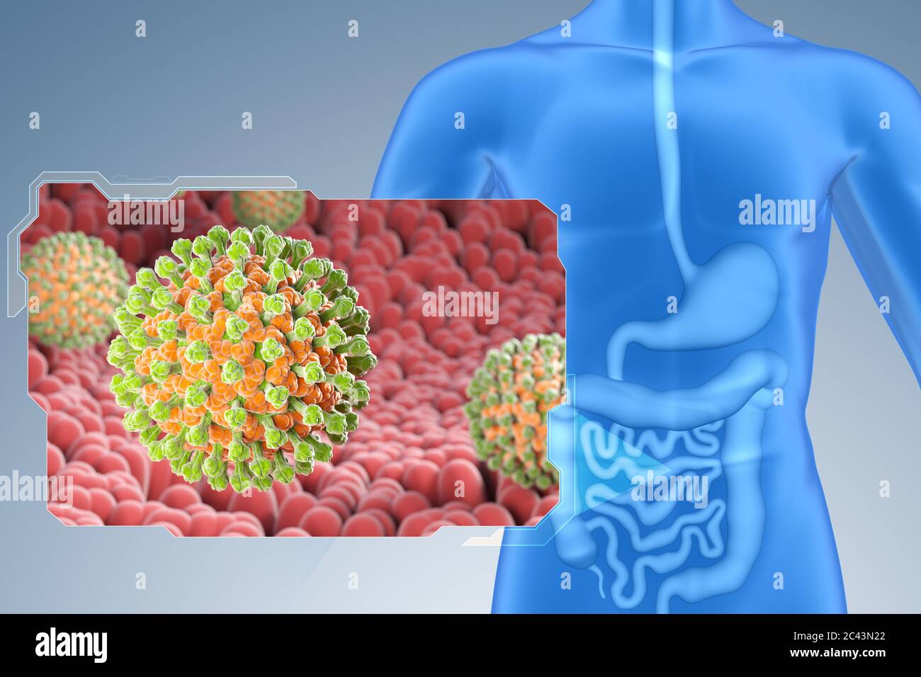 Rotaviruses in small intestine. Rotaviruses are RNA viruses the causative agent of diarrheal disease in children. 3D illustration Stock Photo